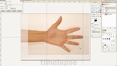 03 - Ortho Hand