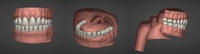 Einar - Inner mouth file