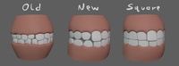 Victoria Teeth Update