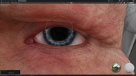 Einar eye deformations